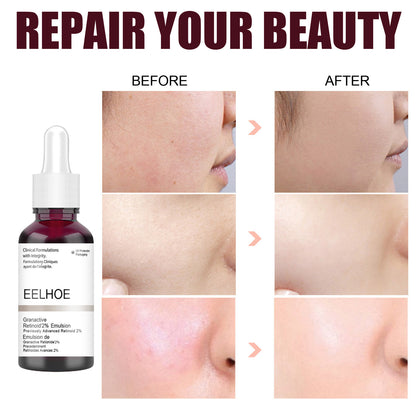 Salicylic Acid Moisturizing Pore Refining Serum